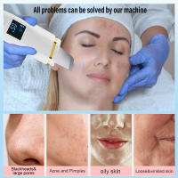 Limpieza Facial Profunda Con Scrubber Ultrasonido Eliminador De Quistes Faciales Y Puntos Negros Espátula De Poros Ultrasonido Scrubber De Piel Recargable - details 1