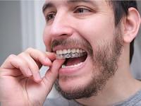 10 Férulas de Descarga Nocturna Perfecta | Ideal Contra Bruxismo, Rechinar los Dientes, Trastornos del ATM, Bandeja blanqueador | Protectores Dentales Ajustables + 1 Estuche | Calidad Médica Sin BPA - details 1