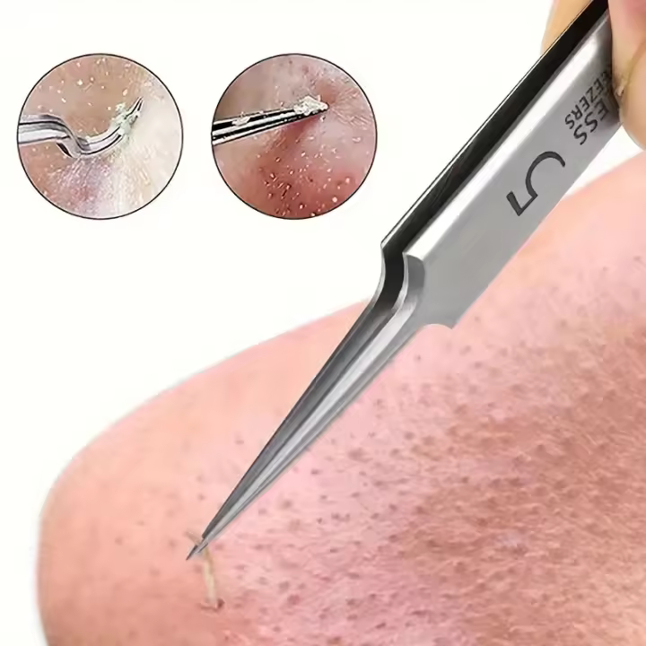 1 Pack Agujas Finas Para Remover Acné Y Blackheads Herramientas De Belleza Facial Para Cuidado De La Piel Tamaño No. 5 - 1