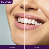 GlamWhite™ Kit de recarga - details 0