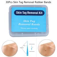 30pcs/pack Eliminador De Etiquetas De Piel Con Cintas De Goma Micro No Tóxicas Para Cuidado Facial Quistes Verrugas Herramientas De Cuidado De La Piel - details 3