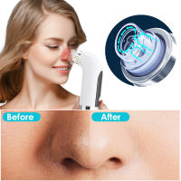 Limpiador de Poros Electrico Succionador, Limpiador Facial Ajustable de 3 Modos, Equipado con 6 Cabezales de Succión Reemplazables, Limpiador Facial con Pantalla LED, Adecuado para Hombres y Mujeres, san valentin regalos mujer - details 14