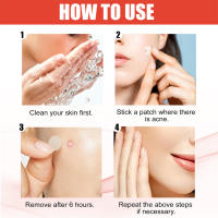 Parches Para Acné Y Marcas De Puntos De Cuidado Facial 144pcs Invisibles Tratamiento De Acné Y Cicatrices De Puntos Para Belleza - details 7