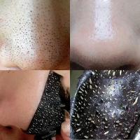 Mascarillas De Tratamiento Contra Acné Y Blackheads Profundo Limpieza Reducción De Poros 10PCS MDUG Sin Fuente Eléctrica Originales De China Continental - details 2