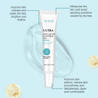 Gel limpiador para el acné OUHOE, gel hidratante con niacinamida para el acné, limpiador suave que reduce la grasa y atenúa el acné. - details 5