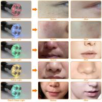Masajeador De Cara Y Cuerpo LED Fototerapia Masajeador De Belleza Electroporación Microcorriente Levantamiento Facial Eliminador De Arrugas Anti-Edad Máquina De Belleza - details 1