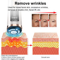 Masajeador Facial De Microcorriente EMS Rejuvenecimiento De Piel Anti-Edad Mini Máquina Hifu Lifting Facial Elevación De Rostro - details 6