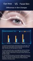 Masajeador Facial Eléctrico Portátil De Energía Concentrada Para Lifting Facial Antiarrugas Hifu Dispositivo De Lifting Facial Cuidado De La Piel Y Ojos - details 4