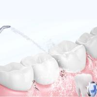 Limpia Dientes Portátil Sin Cable Ortoirrigador Aparato De Higiene Dental Recargable Para Adultos Limpiador De Encías - details 9