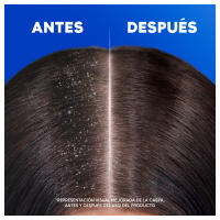 H&S Citrus Fresh Champú Anticaspa para Pelo Graso, con Dispensador. Hasta 100% de Protección Anticaspa, Clínicamente Probado. Para Uso Diario. Frescor y Limpieza con Aroma a Cítricos 800ml - details 1