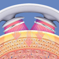 Masajeador De Cuello Inteligente Con Calor Eléctrico Relajación Corporal USB Recargable Blanco Tamaño Multi SML Material ABS & TPR - details 4
