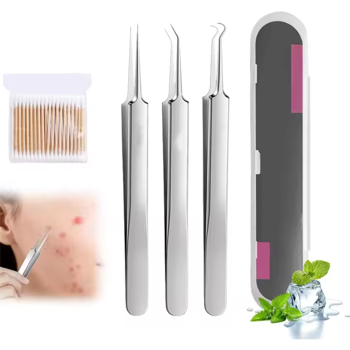 Pinzas para eliminar puntos negros, pinzas profesionales para eliminar puntos negros del rostro, pinzas para el vello facial de las mujeres, pinzas de acero inoxidable para eliminar puntos negros del rostro - 1