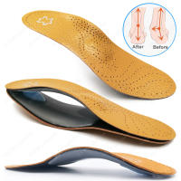 KOTLIKOFF Plantillas De Cuero Para Zapatos Ortopédicos Soporte De Arco Para Pies Planos Adecuado Para Hombres Y Mujeres Corrección De Pierna O/X - details 3