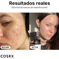 COSRX The Niacinamide 15 sérum facial ultraligero de rápida absorción con Niacinamide 15% + Zinc PCA 1% - details 2