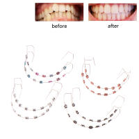 1 Par De Decoraciones Colores Para Dientes Con Alambre De Metal Y Ligaduras Ortodónticas Adornos Dentales Temporales Para La Piel - details 1