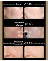 Máquina De Levantamiento Facial HIFU Masajeador Facial Portátil Terapia De Luz Roja Aparato De Belleza Y Salud Con Vibration Skincare - details 19