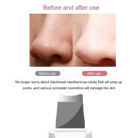 Limpieza Profunda Facial Con Scrubber Ultrasonido Dispositivo De Cuidado Personal Belleza Eliminador De Quistes Cutáneos USB Acrylic - details 3
