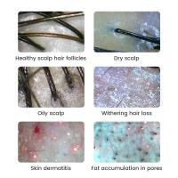 Microscopio Digital WiFi Inalámbrico Analizador De Piel Facial Con Magnificador De Poros Detecta Escalpelo Profesional Acrílico USB - details 4