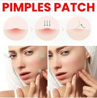 200pcs Parches De Reparación Para Acné Facial Cuidado De La Piel Elimina Manchas De Espinillas Y Acné Parches Para Cubrir Y Reparar - details 5