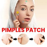 200pcs Parches De Reparación Para Acné Facial Cuidado De La Piel Elimina Manchas De Espinillas Y Acné Parches Para Cubrir Y Reparar - details 6