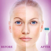 BIT Rodillo facial con microagujas - details 2