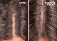 Ronquina Kesmar con Extracto de Hierbas – Tónico Capilar Revitalizante para un Cabello Fuerte y Saludable – Anticaída y Estimulante del Crecimiento – Uso Diario - details 0