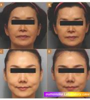 Máquina De Levantamiento Facial HIFU Masajeador Facial Portátil Terapia De Luz Roja Aparato De Belleza Y Salud Con Vibration Skincare - details 10