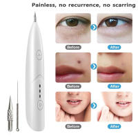 Nuevo mini Bolígrafo USB de Tres velldades para Lunares, Pecas, Manchas, carbonización iónica, use doméstico - details 3
