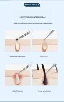 11Pcs Aparatos De Cuidado De La Piel Para Rostro Herramientas De Limpieza Profunda De Poros Agujas Para Eliminación De Acné Y Puntos Negros Herramientas De Pelaje - details 3