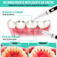 Garaldentist Cepillo dental Raspador Ultrasonico, Limpiador de sarro y placa - Eliminador de Sarro y Placa, 3 Modos. Carga USB C, Color blanco, Iluminador led, Antisarro + 4 Herramientas profesionales, Envio 1-3 dias habiles, intrucciones en español. - details 3