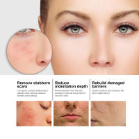 La esencia facial de niacina EELHOE atenúa las marcas del acné, hidrata, reduce los poros, blanquea la piel y embellece la piel. - details 6