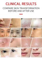 Máscara De Luz LED Para El Rostro 7 En 1 Dispositivo De SPA Facial Rejuvenecimiento De La Piel Máquina De Belleza Corporal Para El Cuidado De La Piel - details 9
