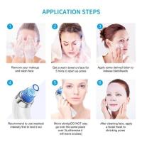 Aspirador de puntos Negros facial, extractor eléctrico de granos y acné: eliminar puntos Negros y acné A561 - details 1