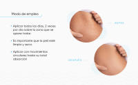 Sodermol Crema Antiestrias para el Embarazo | Previene y Reduce Estrias | Gel con Rosa Mosqueta Postparto - details 2