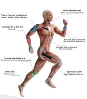 Parche Muscular De Rodilla Protector De Músculo Alivio Del Dolor Banda Elástica Recuperación Deportiva Cinta De Estiramiento Para Gimnasio Fitness Tenis Correr Unisex - details 5