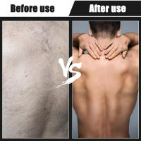 Afeitadora De Espalda Para Hombres 2 En 1 Con Mango Largo Antideslizante Afeitadora De Pelo De Espalda Para Baño Seco Y Húmedo - details 5
