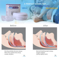 Dispositivo Antisnore Reutilizable Con Caja De Almacenamiento Mascarilla Para Dormir Reducción De Bruxismo Material EVA+PC - details 8