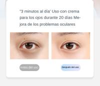 Dispositivo De Belleza Para Los Ojos BoSidin EMS Microcorriente Antiarrugas Elimina Bolsas Y Círculos Oscuros Terapia De Luz Elevación Y Masaje De Los Ojos - details 7