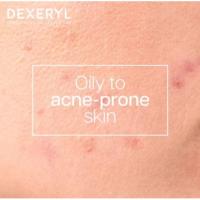 Dexeryl Dexeclear Gel Limpiador Anti‑Imperfecciones 400 ml – Piel Grasa y con Tendencia Acneica - details 2