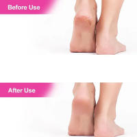 Archilla De Pie De Acero Inoxidable Doble Cara Para Eliminar Callos Y Piel Muerta Herramienta De Masaje Para Los Pies - details 3