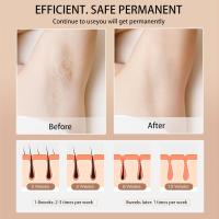 Dispositivo De Eliminación De Vello IPL Para Mujeres 990000 Flashes Láser Permanente Sin Dolor Para Cuerpo Bikini Y Cabello Facial Uso Doméstico - details 3