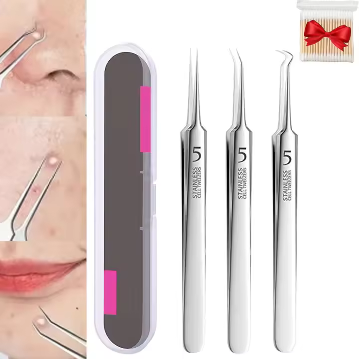 Pinzas para quitar puntos negros, pinzas profesionales para quitar puntos negros del rostro y la nariz, extractor de puntos negros - 1