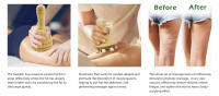 Masajeador De Madera Para Masaje Estático Sueco Con Setas Herramienta De Terapia Para Relajación Muscular Y Drains Límpico Anticelulitis - details 1