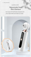 Quita Puntos Negros Eléctrico Recargable Por USB Herramienta De Eliminación De Imperfecciones Para Rostro De Hombres Y Mujeres - details 2