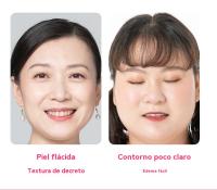 Masajeador facial EMS, cinturón elevador en forma de V, plegable, luz roja y azul, LED, vibración adelgazante, mejora la elasticidad de la piel, terapia de fotones, masaje facial vibratorio, adelgazante, elimina la papada, levanta y tensa - details 6
