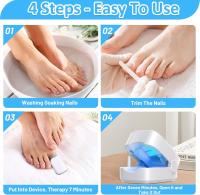 Dispositivo de Tratamiento de Hongos en las Uñas, Aparato de Tratamiento Láser de Hongos de Uñas Hongos de Uñas de Los pies Limpieza Reparación de Uñas Tratamiento de Hongos de Uñas. - details 1