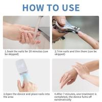 Dispositivo de lámpara de limpieza de hongos de uñas, solución de uso eficaz para uñas gruesas y decoloradas dañadas, para uso doméstico, eliminador de hongos de uñas recargable - details 1