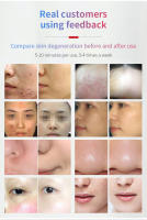 Spray De Hidratación Facial Mist Airbrush Profundo Limpiador Oxygenador Inyector Sin Cable Compresor De Pincel Multiusos Para Belleza - details 11