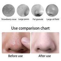 Máquina Peeling Ultrasonico Limpiador ultrasónico de poros para espinillas Instrumento de limpieza de rejuvenecimiento de la piel caliente Ion Import Beauty - details 4