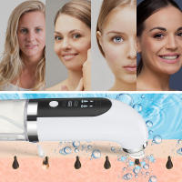 Limpiador de Poros Electrico Succionador, Limpiador Facial Ajustable de 3 Modos, Equipado con 6 Cabezales de Succión Reemplazables, Limpiador Facial con Pantalla LED, Adecuado para Hombres y Mujeres, san valentin regalos mujer - details 16